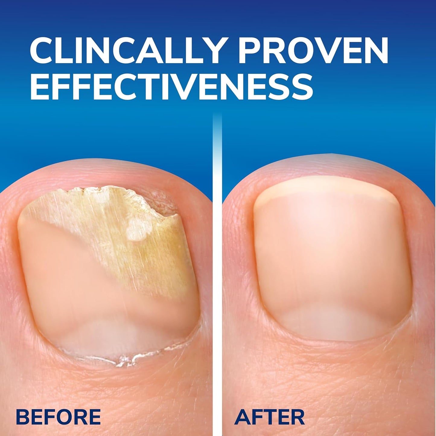 Nail Revival Treatment Solution